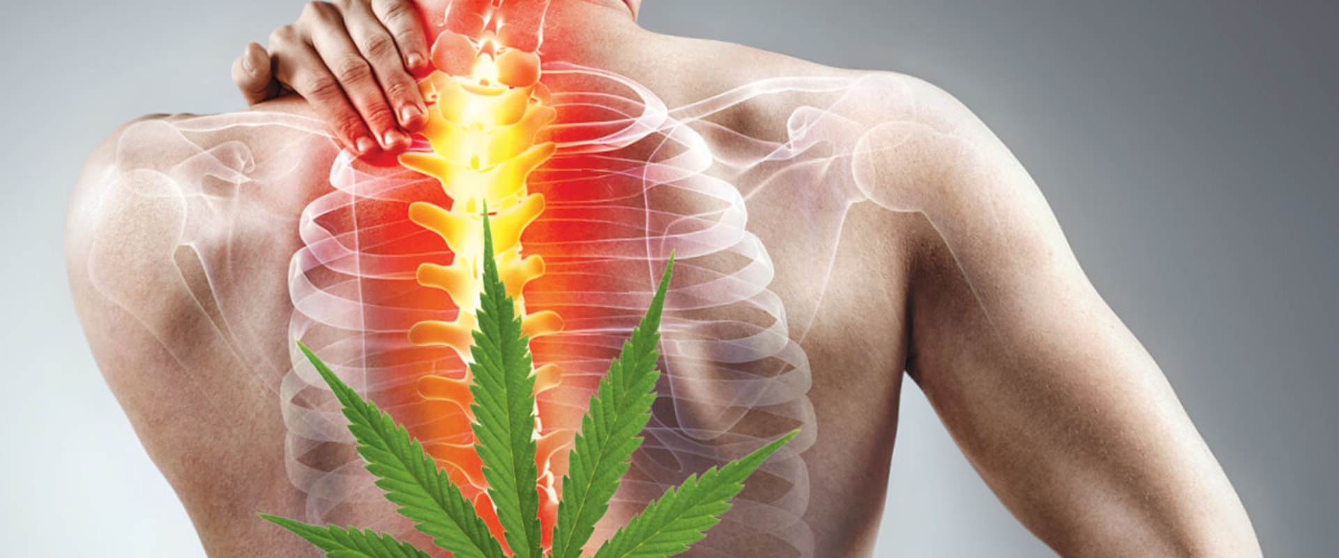 Creating a Sense of Belonging and Acceptance: How Medical Cannabis Can Help with Pain Relief