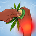 Managing Nerve Pain with Cannabis